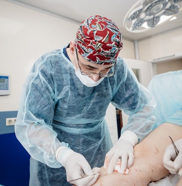tratamentul chirurgical al venelor varicoase