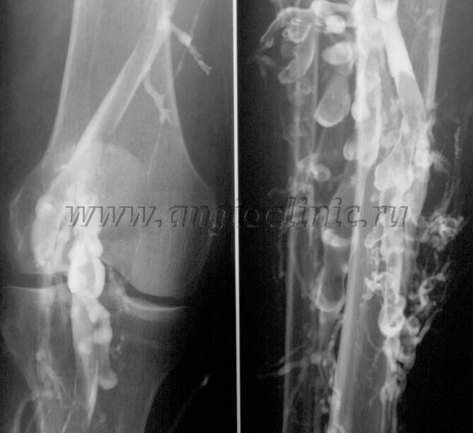 Scanare cu ultrasunete